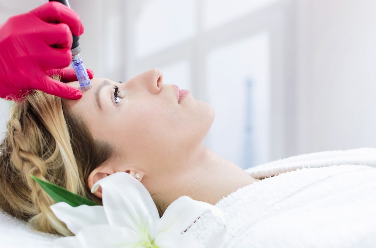 Microneedling-Behandlung mit dem Derma-Pen